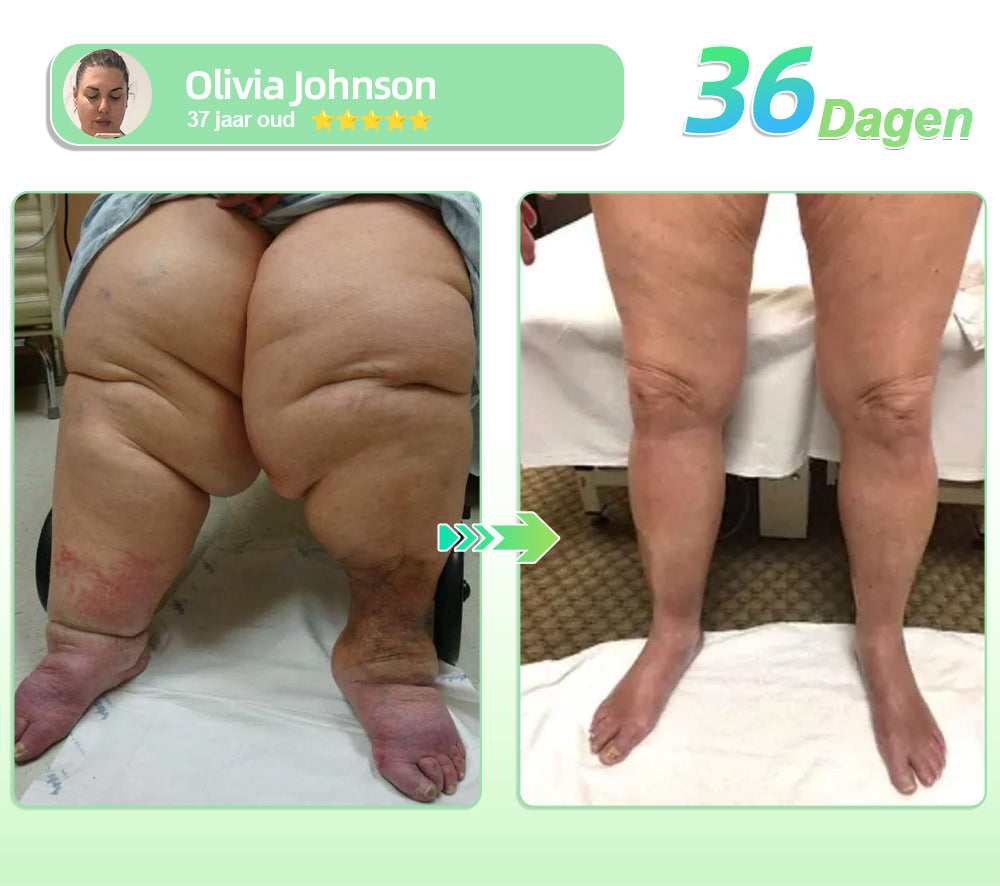 𝐋𝐞𝗿𝗰𝐞𝐚® 𝐆𝐋𝗣-𝟏 𝐀𝐟𝐬𝐥𝐚𝐧𝐤- 𝐞𝐧 𝐠𝐞𝐳𝐨𝐧𝐝𝐡𝐞𝐢𝐝𝐬𝐞𝐬𝐬𝐞𝐧𝐜𝐞 𝐢𝐧 𝐮𝐥𝐭𝐫𝐚-𝐠𝐞𝐜𝐨𝐧𝐜𝐞𝐧𝐭𝐫𝐞𝐞𝐫𝐝𝐞 𝐯𝐥𝐨𝐞𝐢𝐛𝐚𝐫𝐞 𝐝𝐫𝐮𝐩𝐩𝐞𝐥𝐬✨𝐬𝐧𝐞𝐥 𝐰𝐞𝐫𝐤𝐞𝐧𝐝, 𝐥𝐚𝐧𝐠𝐝𝐮𝐫𝐢𝐠 𝐞𝐟𝐟𝐞𝐜𝐭, 𝐡𝐞𝐥𝐩𝐭 𝐛𝐢𝐣 𝐝𝐢𝐚𝐛𝐞𝐭𝐞𝐬, 𝐨𝐛𝐞𝐬𝐢𝐭𝐚𝐬 𝐞𝐧 𝐡𝐚𝐫𝐭- 𝐞𝐧 𝐯𝐚𝐚𝐭𝐳𝐢𝐞𝐤𝐭𝐞𝐧 🎉🎉