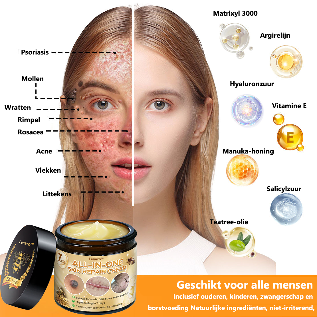 [Officiële merkwinkel]👑 𝐋𝐞𝐧𝐚𝐫𝐨® Belgische Dermatologisch Gecertificeerde Bijengif Crème voor Alle Toepassingen （👩‍⚕️BSD Aanbevolen）