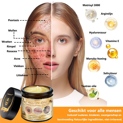 [Officiële merkwinkel]👑 𝐋𝐞𝐧𝐚𝐫𝐨® Belgische Dermatologisch Gecertificeerde Bijengif Crème voor Alle Toepassingen （👩‍⚕️BSD Aanbevolen）