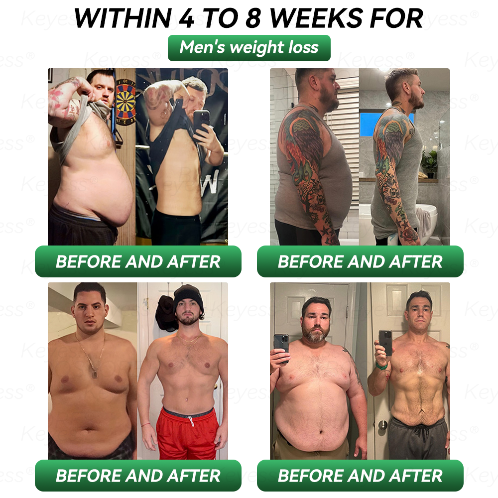 𝐎𝐟𝐟𝐢𝐜𝐢𝐚𝐥 𝐒𝐭𝐨𝐫𝐞|👩‍⚕️𝗟𝗲𝗿𝗰𝗲𝗮® 𝗚𝗟𝗣-𝟭 & 𝗠𝗮𝘁𝗿𝗶𝘅𝘆𝗹 3000 Health 7 in 1 Body Balance 𝐎𝐫𝐚𝐥 𝐒𝐨𝐥𝐮𝐭𝐢𝐨𝐧 For obesity, sagging skin, cardiovascular health, diabetes, sleep apnea, joint problems, etc.🌷