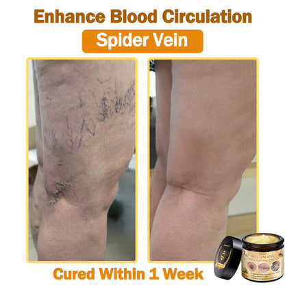 [Officiële merkwinkel]👑 𝐋𝐞𝐧𝐚𝐫𝐨® Belgische Dermatologisch Gecertificeerde Bijengif Crème voor Alle Toepassingen （👩‍⚕️BSD Aanbevolen）