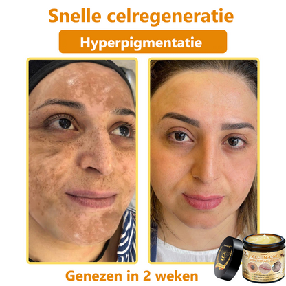 [Officiële merkwinkel] 💎 𝐋𝐞𝐧𝐚𝐫𝐨® Belgische Dermatologisch Gecertificeerde Bijengif Crème voor Alle Toepassingen （👩‍⚕️BSD Aanbevolen）
