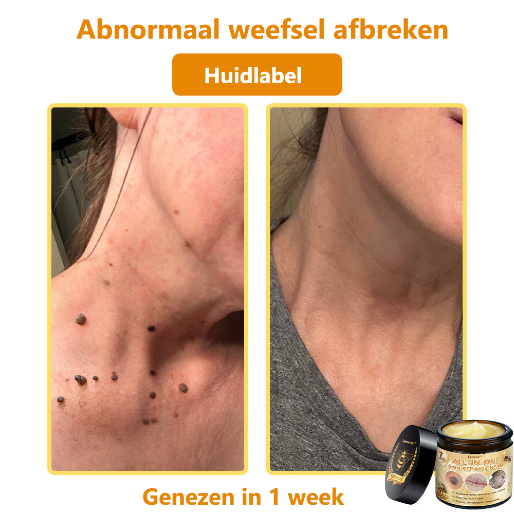 [Officiële merkwinkel] 💎 𝐋𝐞𝐧𝐚𝐫𝐨® Belgische Dermatologisch Gecertificeerde Bijengif Crème voor Alle Toepassingen （👩‍⚕️BSD Aanbevolen）